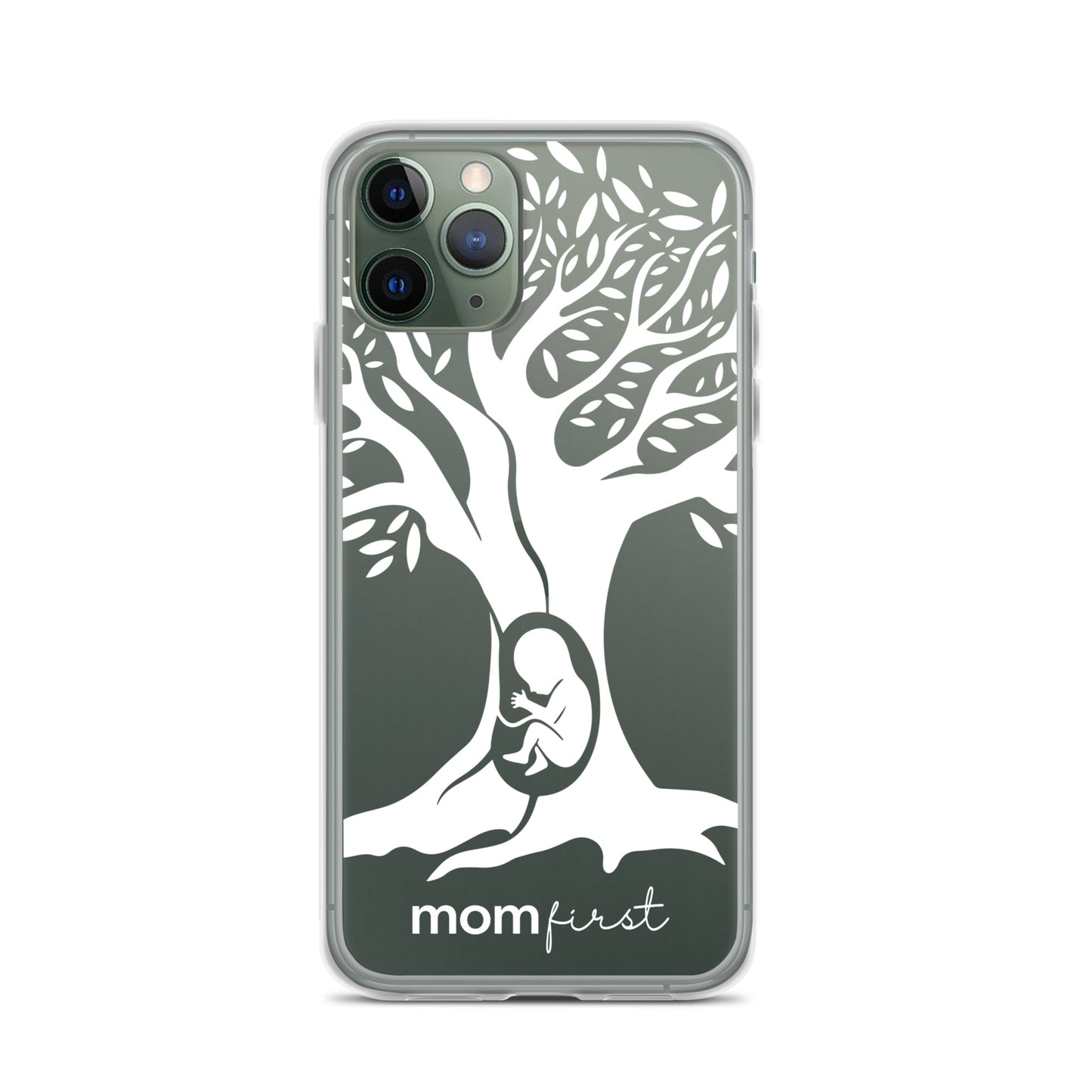 Clear Case for iPhone® - White Logo