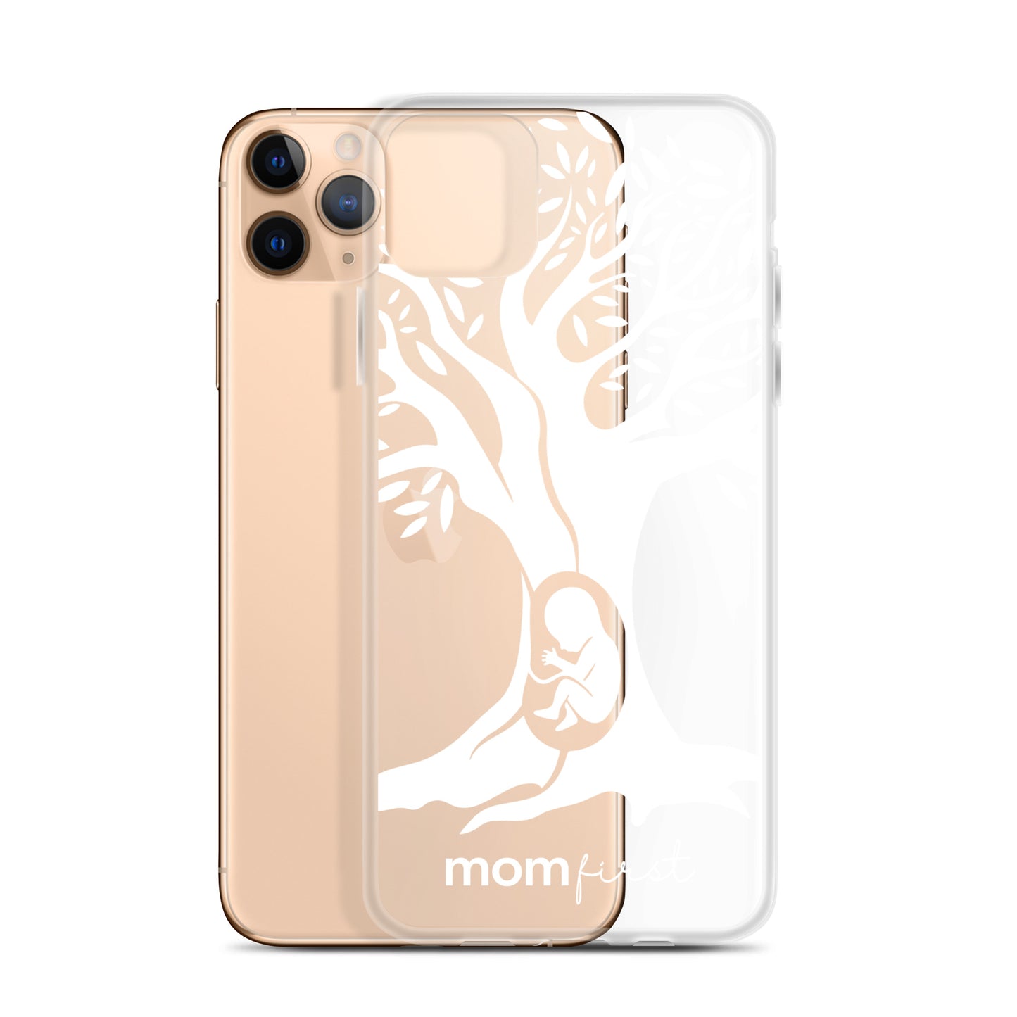 Clear Case for iPhone® - White Logo