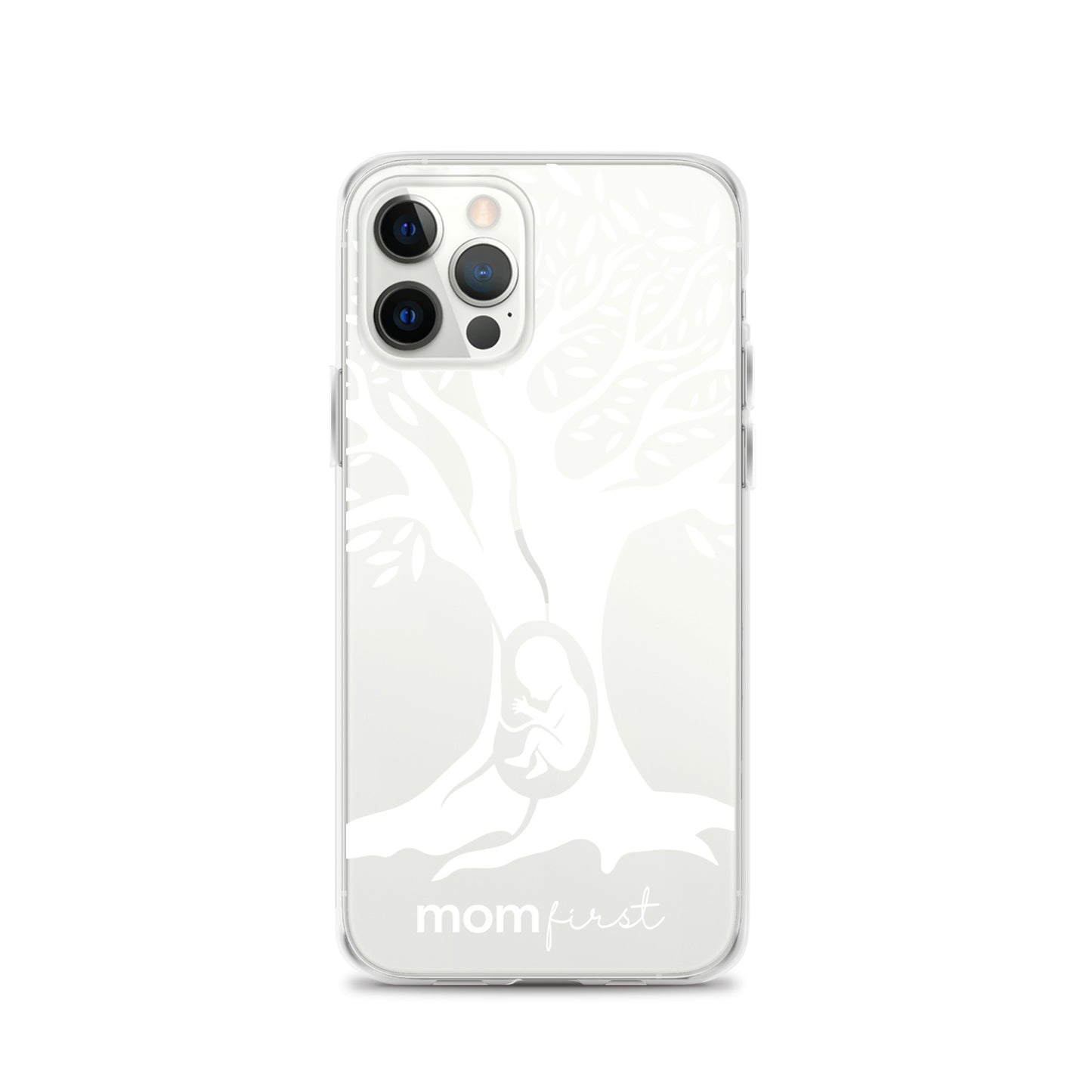 Clear Case for iPhone® - White Logo