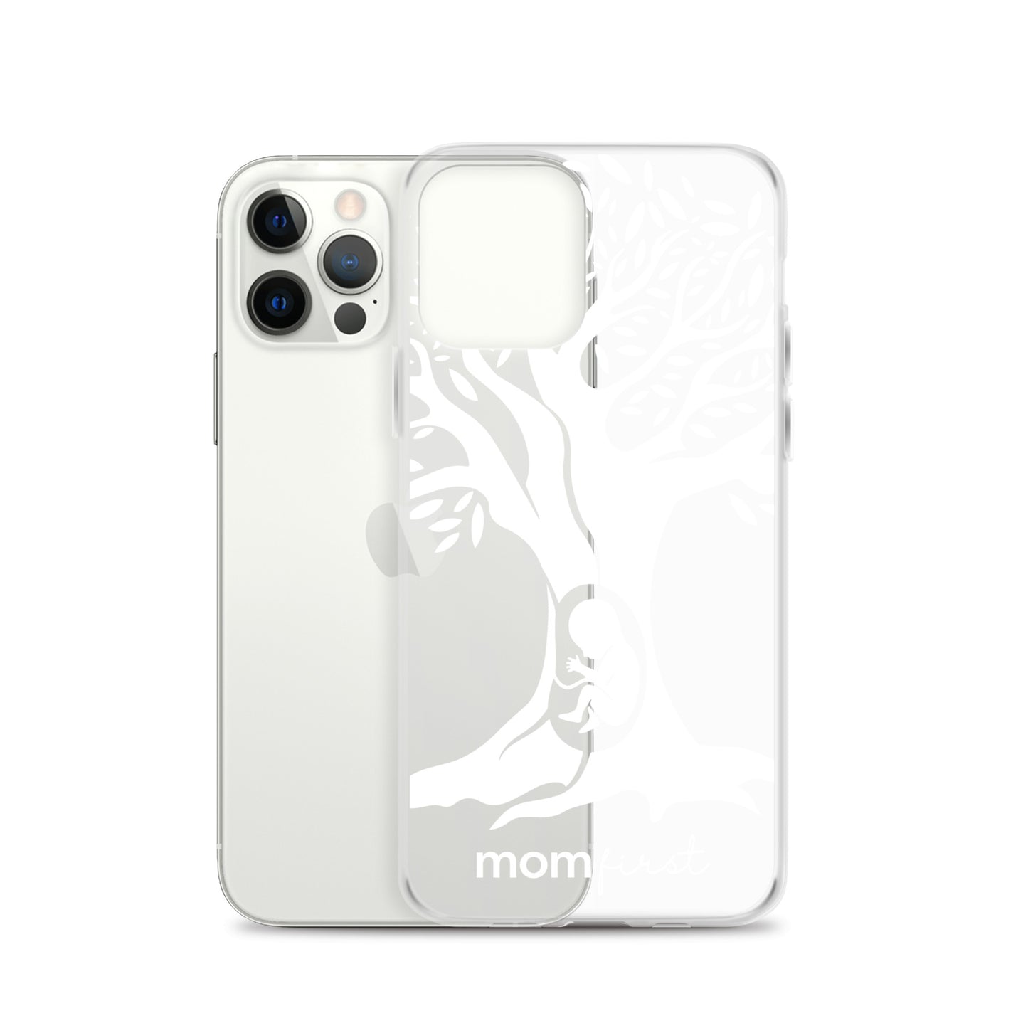 Clear Case for iPhone® - White Logo