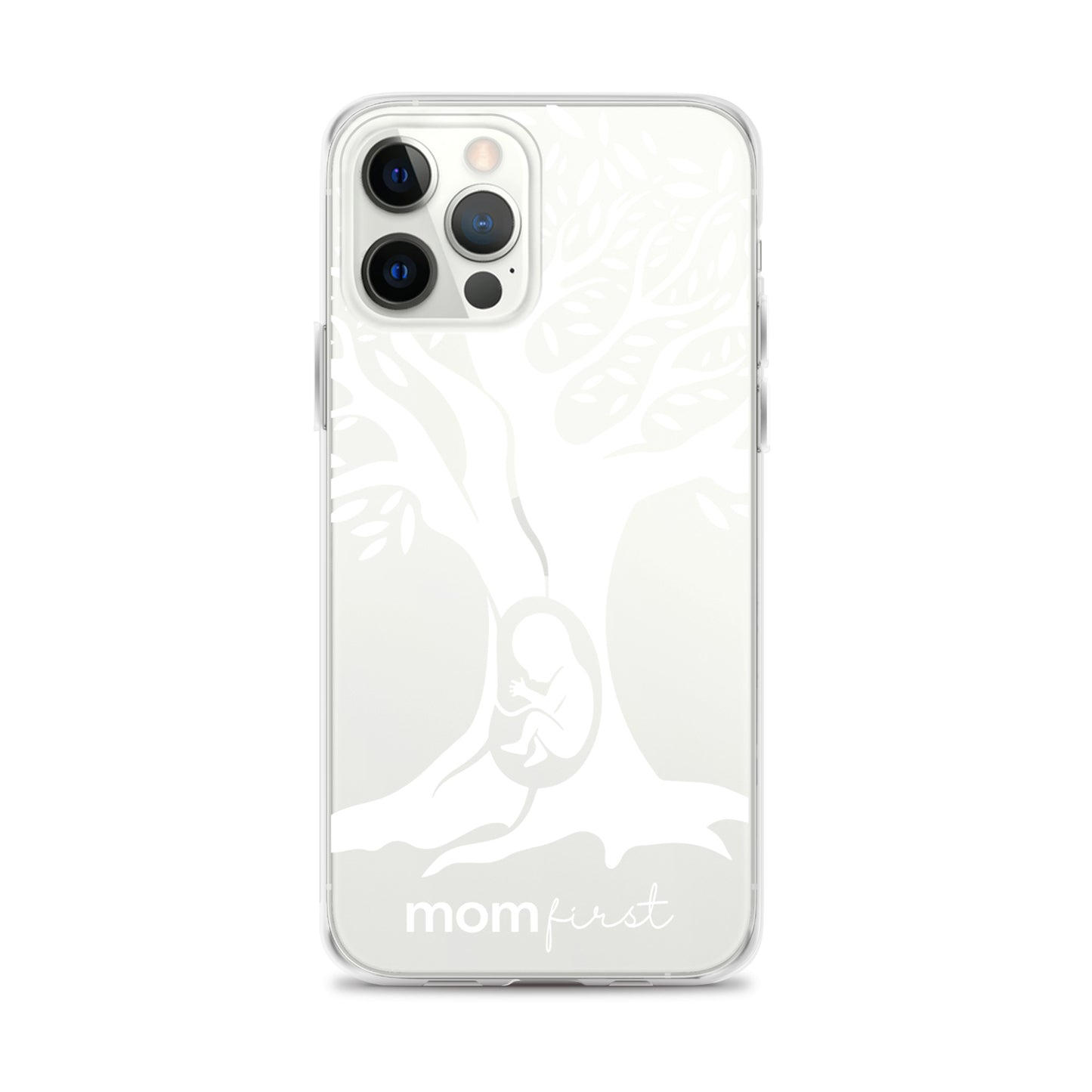 Clear Case for iPhone® - White Logo